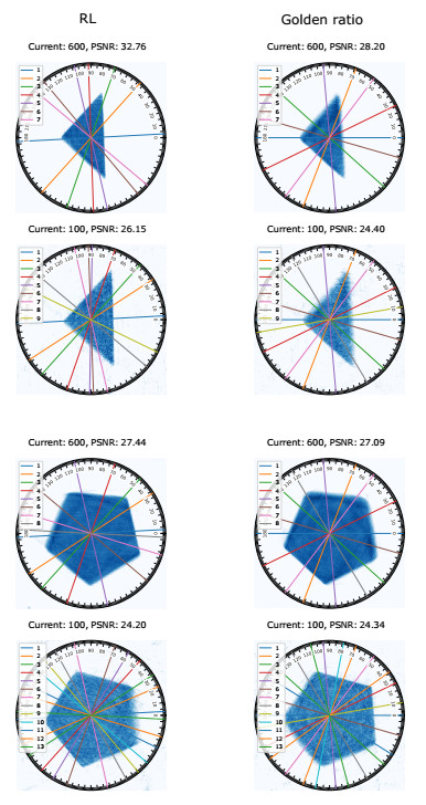 Which Muscle Inverted Ray Target Dynamic angle selection in X-Ray CT: A reinforcement learning approach ...