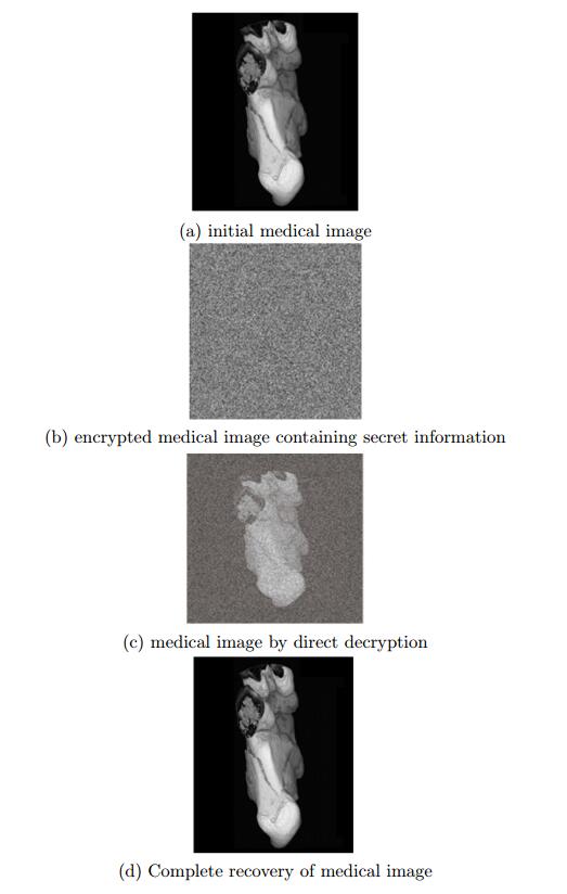 An algorithm for reversible information hiding of encrypted medical ...