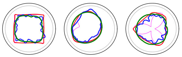 Robin Condition Shape optimization methods for detecting an unknown boundary with the ...