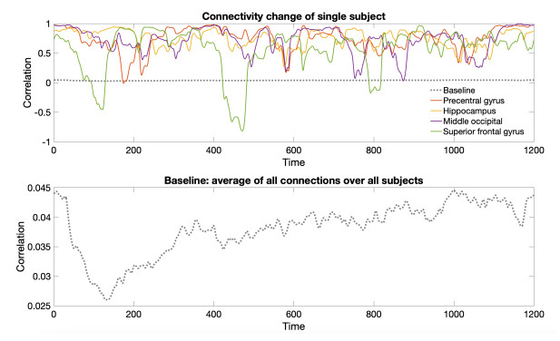 Dynamic topological data analysis of functional human brain networks