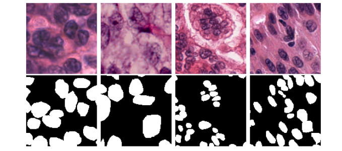 Automatic extraction of cell nuclei using dilated convolutional network
