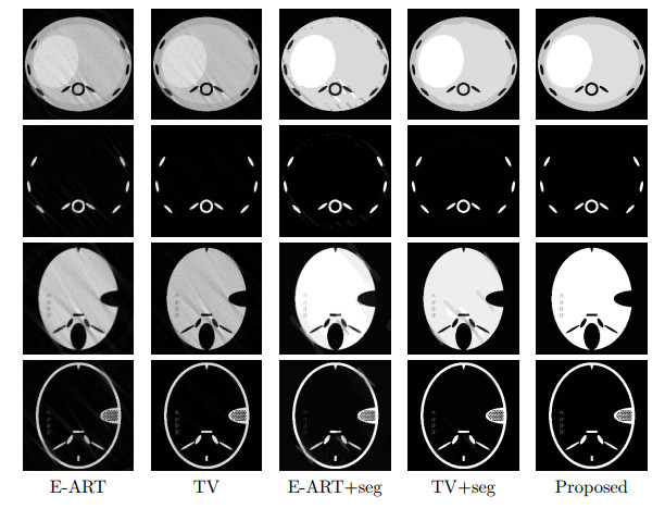 Ct Iterative Reconstruction Algorithm Superiorized iteration algorithm for CT image simultaneous ...