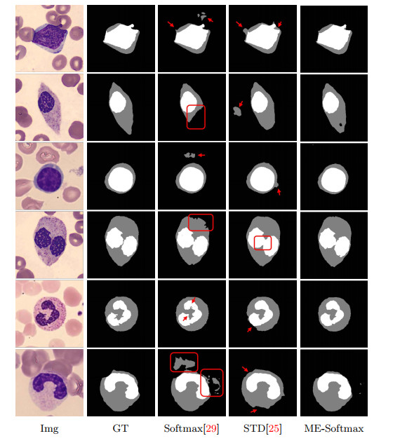 Learnable boundary enhanced Softmax layer based on gray morphology for ...