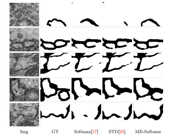 Learnable boundary enhanced Softmax layer based on gray morphology for ...
