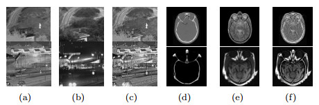 Multi-focus image fusion based on HOSVD and parameter adaptive PCNN in ...